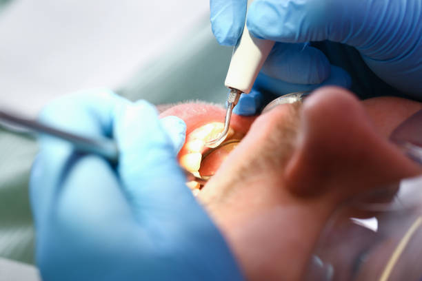 Best 24-Hour Emergency Dental Care in Quinnesec, MI